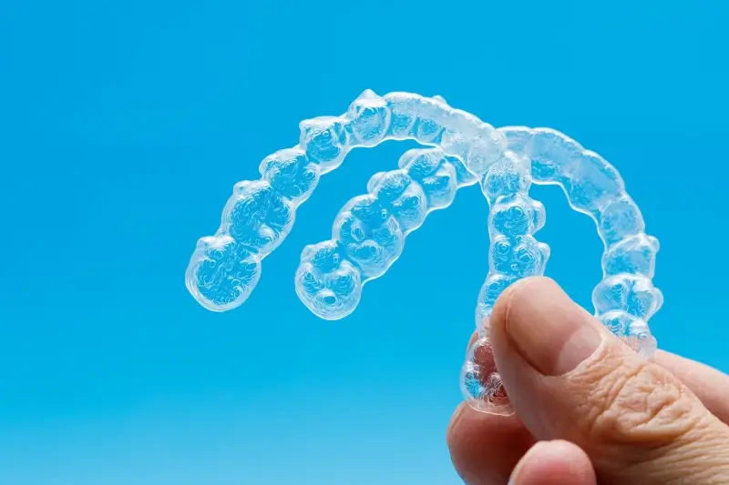 Aparat nakładkowy Invisalign