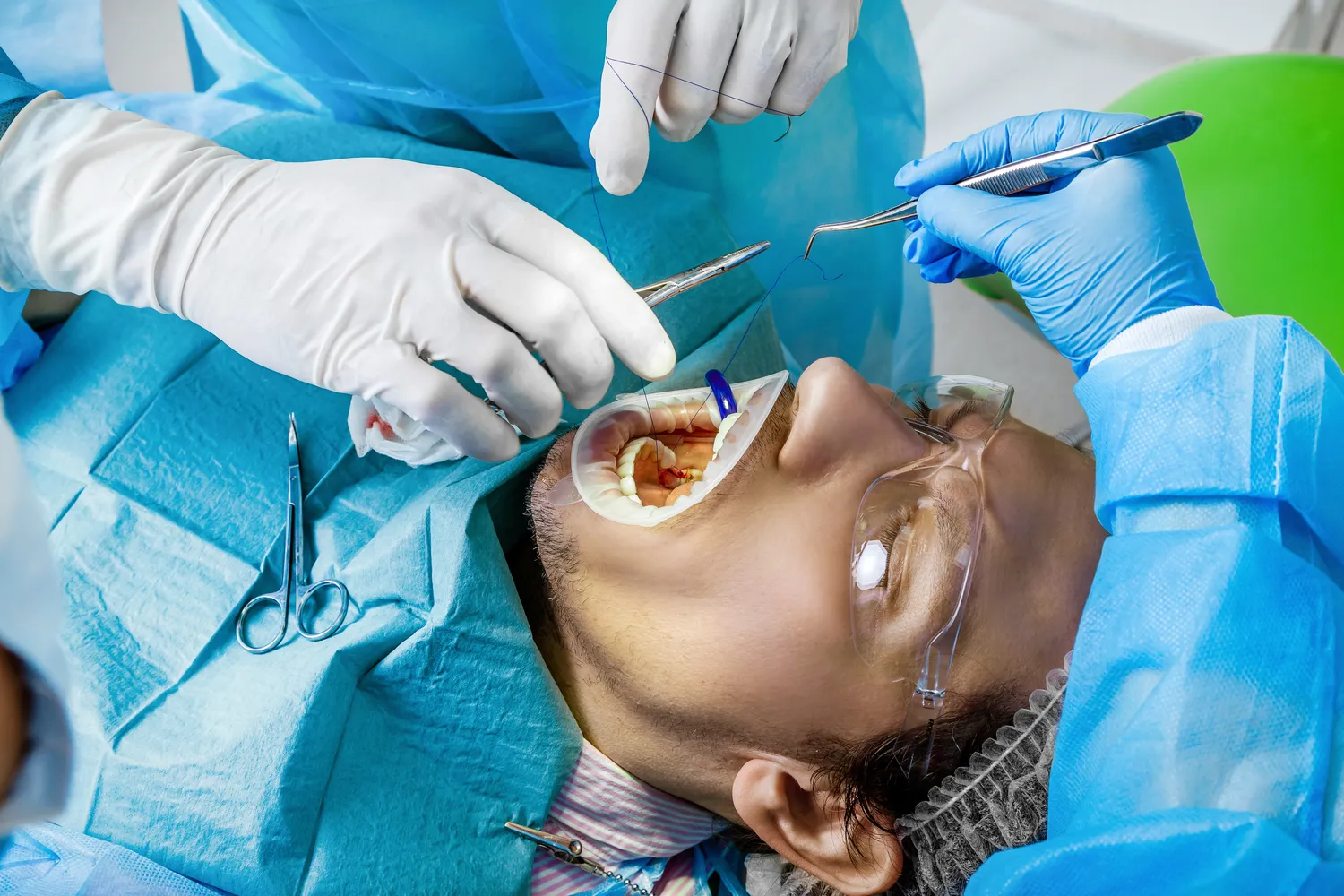 E recepta co jest na recepcie?