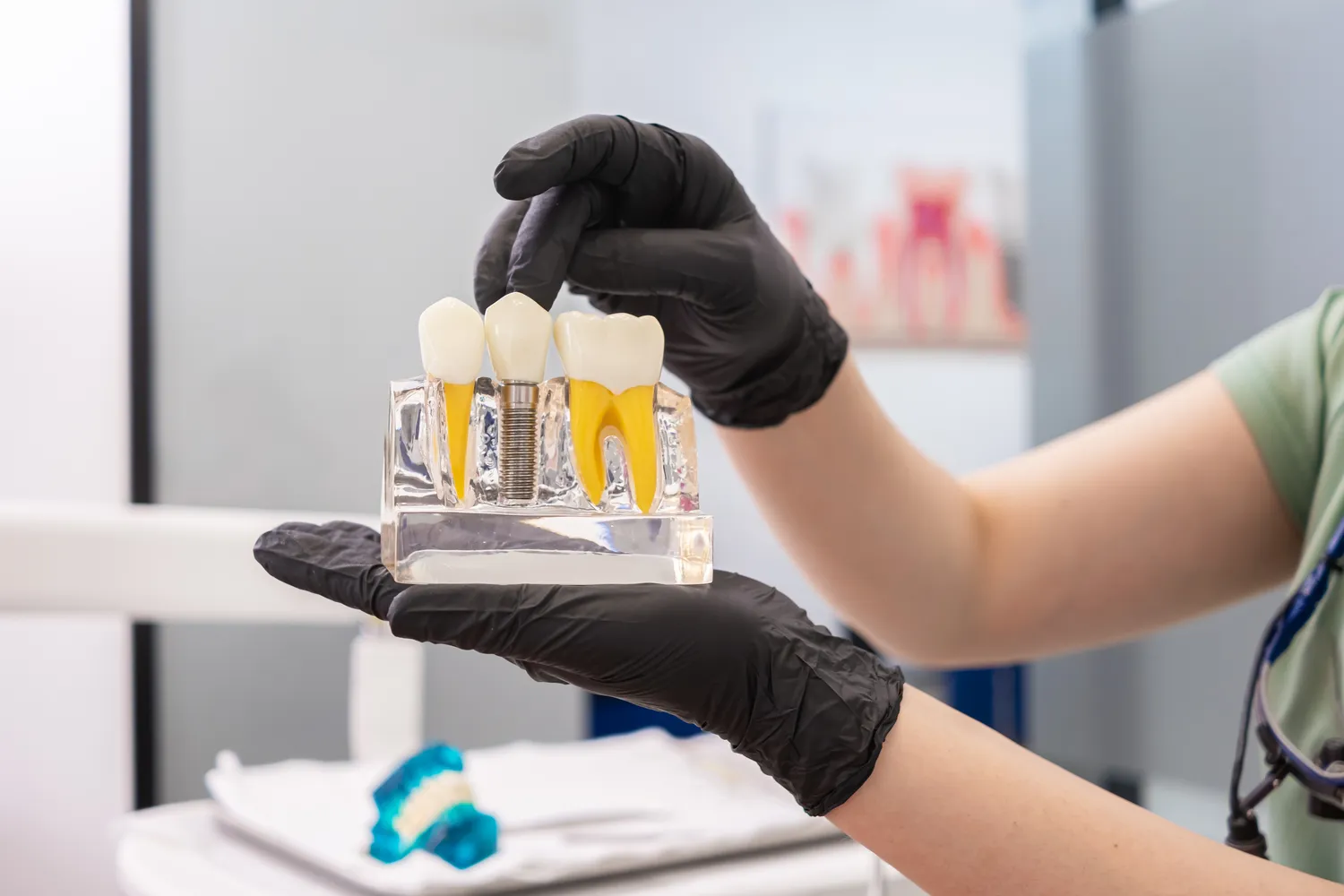 Ile trwa kanałowe leczenie?