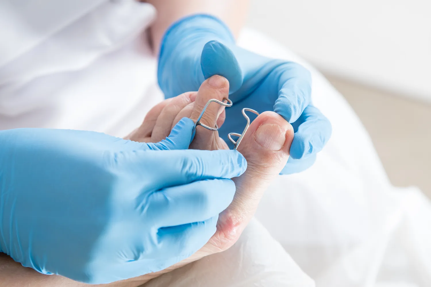 Najczęściej pojawiające się problemy podologiczne